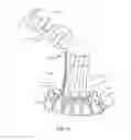Fig. 19 - Surgical implant system and method