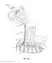 Fig. 20 - Surgical implant system and method
