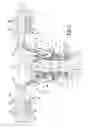 Fig. 02 - Reduction instrument, surgical assembly including a reduction instrument and related method