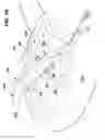Fig. 49 - Bone repair system, kit and method