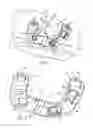 Fig. 02 - Fixation device and method of use for a lapidus-type plantar hallux valgus procedure