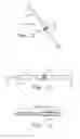 Fig. 02 - FIXATION OF ORTHOPAEDIC DEVICES