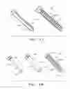 Fig. 07 - FIXATION OF ORTHOPAEDIC DEVICES