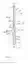 Fig. 01 - ARTHRODESIS DEVICE AND METHOD OF USE