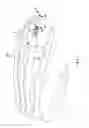 Fig. 02 - ARTHRODESIS DEVICE AND METHOD OF USE