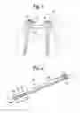 Fig. 02 - Surgical ratchet tool, system and method