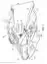 Fig. 02 - Osteotomy opening jack