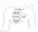 Fig. 01 - Electrical energy delivery tissue site validation