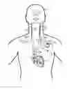 Fig. 01 - Implantable neurostimulator-implemented method for managing tachyarrhythmic risk during sleep through vagus nerve stimulation