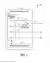 Fig. 03 - Estimating electromechanical delay to optimize pacing parameters in RBBB patients