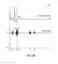 Fig. 07 - Estimating electromechanical delay to optimize pacing parameters in RBBB patients