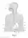 Fig. 02 - Selectively Reducing Excess Consumption and/or Absorption of Unhealthy Food using Electrical Stimulation