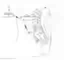 Fig. 01 - Low frequency electrical stimulation therapy for pelvic floor disorders