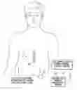 Fig. 01 - Systems and methods for providing a distributed virtual stimulation cathode for use with an implantable neurostimulation system