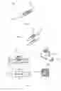 Fig. 09 - Spinal cord stimulator system