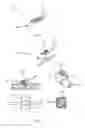 Fig. 09 - Spinal cord stimulator system