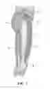 Fig. 03 - Device and methods for preventing knee sprain injuries