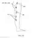 Fig. 04 - Device and methods for preventing knee sprain injuries