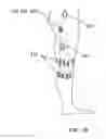 Fig. 05 - Device and methods for preventing knee sprain injuries