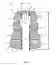 Fig. 03 - Patient warming device with patient access