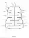 Fig. 06 - Patient warming device with patient access