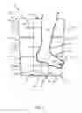 Fig. 09 - Patient warming device with patient access