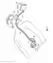 Fig. 02 - Apparatus and method of gastric cooling using balloon catheter