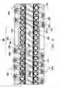 Fig. 07 - MRI compatible implantable lead