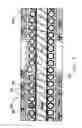 Fig. 08 - MRI compatible implantable lead