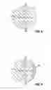Fig. 07 - Implantable Electrode