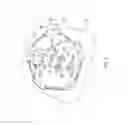 Fig. 05 - Kits and methods for implanting an implantable lead extension