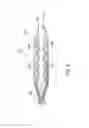 Fig. 09 - Kits and methods for implanting an implantable lead extension