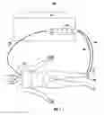 Fig. 02 - Focal tissue stimulator