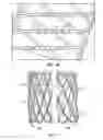 Fig. 06 - Secured strand end devices