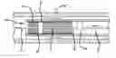 Fig. 01 - Braided stent with expansion ring and method of delivery