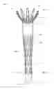 Fig. 02 - Loading tool for capturing stent points