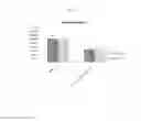 Fig. 04 - Medical device and plasticized nylon
