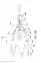 Fig. 43 - Hemostasis valve and delivery systems