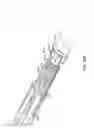 Fig. 52 - Hemostasis valve and delivery systems