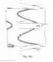 Fig. 65 - Hemostasis valve and delivery systems