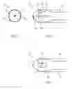 Fig. 03 - WIRELESS MEDICAL DEVICE RELEASE MECHANISM