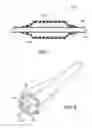 Fig. 02 - Inflatable balloon and cover