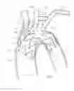 Fig. 04 - Endoluminal prosthesis system