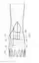 Fig. 07 - Endoluminal prosthesis system