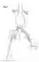 Fig. 07 - Extension for iliac branch delivery device and methods of using the same
