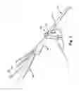Fig. 04 - SYSTEMS AND METHODS FOR COMPRESSING, CRIMPING AND LOADING A STENT