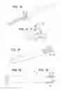 Fig. 07 - Delivery system for a self-expanding medical device