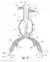 Fig. 05 - Endograft device delivery systems and associated methods