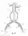 Fig. 06 - Endograft device delivery systems and associated methods