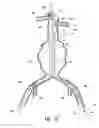 Fig. 07 - Endograft device delivery systems and associated methods